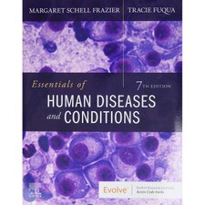 Essentials of Human Diseases and Conditions (7E 21)
